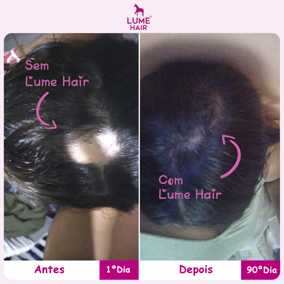 Resultado Lume Hair